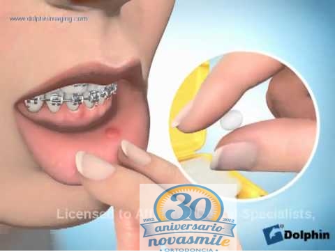 Incidencias en los tratamientos de ortodoncia